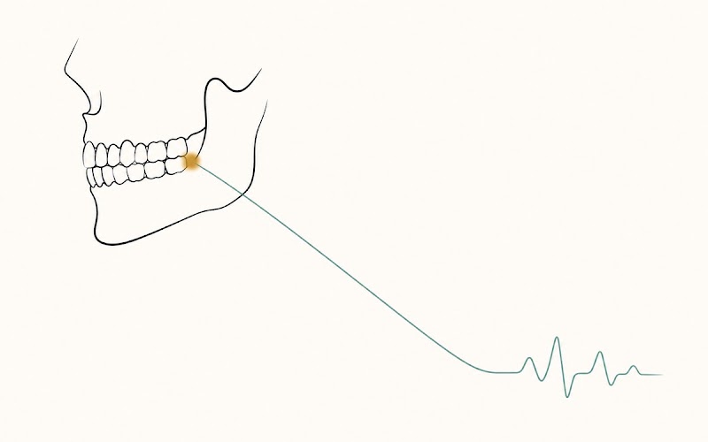 Jaw and skull profile with a teal line emanating from the bite point, transitioning into an HRV waveform